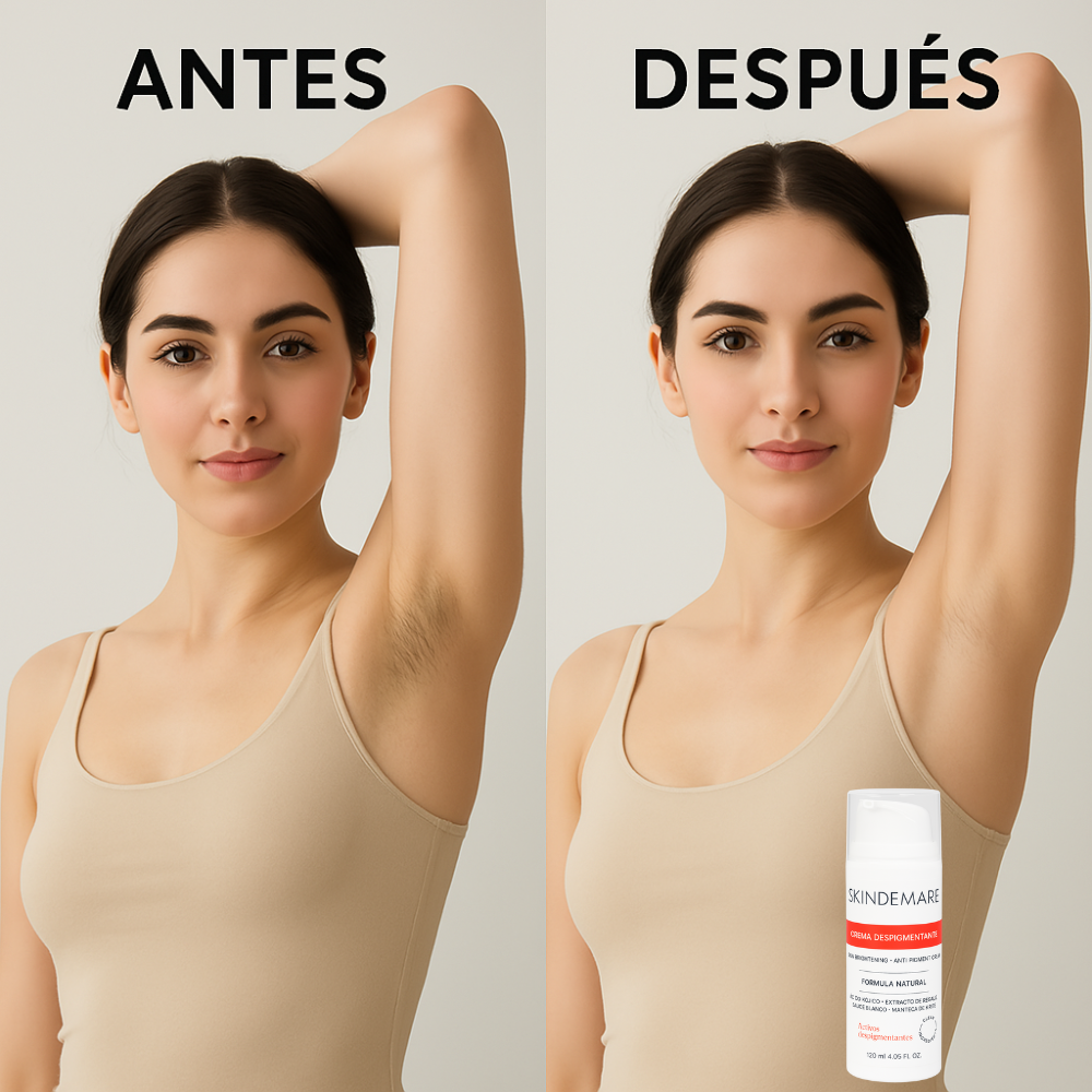 Crema Aclaradora Para Zonas Íntimas | Despigmentante 120ml SkinDemare